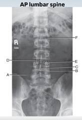 <p>label (a-c) AP lumbar spine</p>