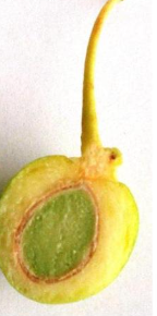 <p>Describe the 3 layers of the Ginkgo biloba seed coat.</p>