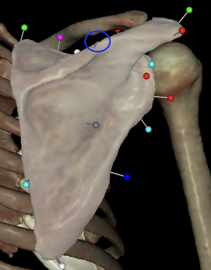 <p>What is the circled region called on the <strong>right</strong> scapula?</p>