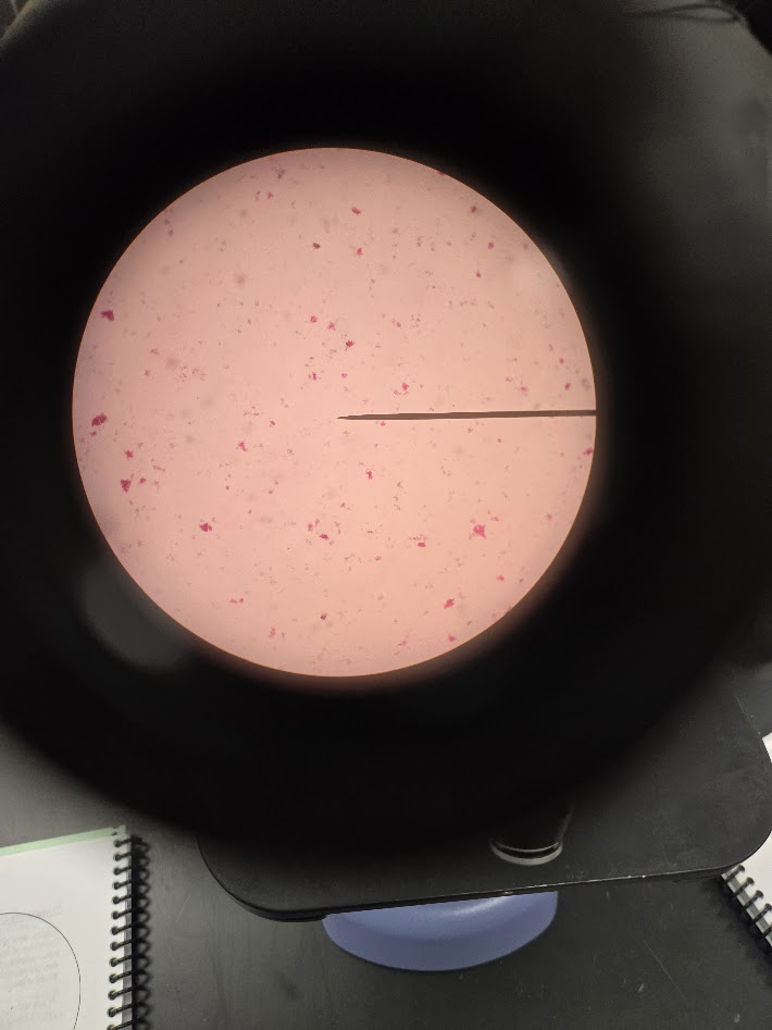 <ol><li><p>what phylum is this bacteria?</p></li><li><p>is it gram positive or gram negative?</p></li></ol><p></p>