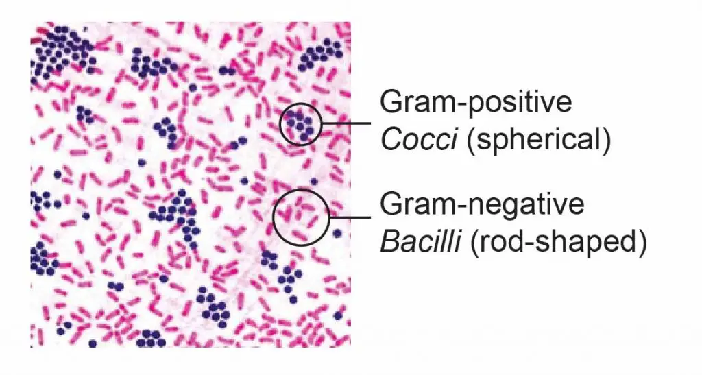 <p>Single wall layer with large amounts of peptidoglycan (stain the cytoplasm and appear violet)</p>