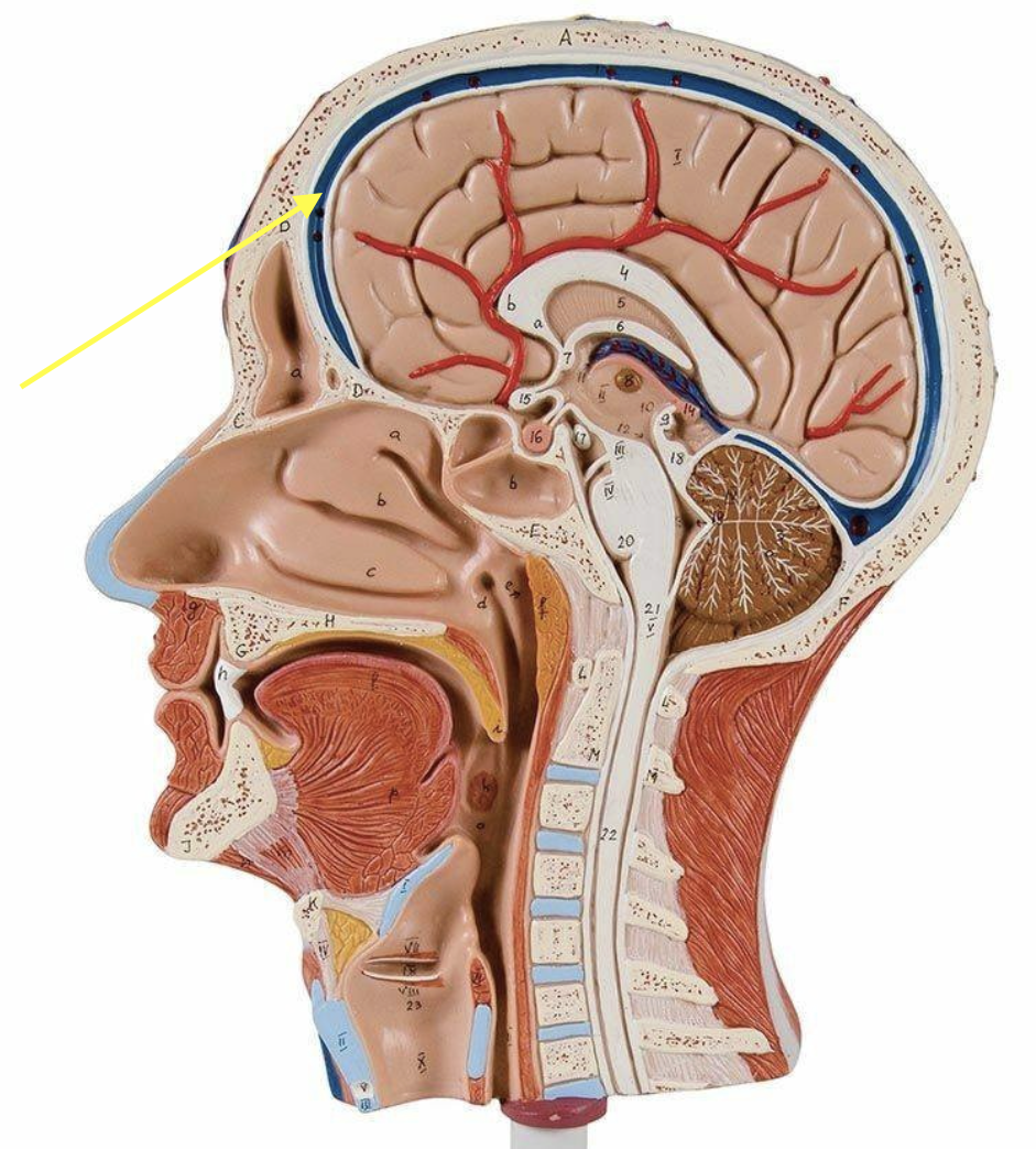 <p><strong>Location: Within dura mater (between layers); Function: Drains venous blood from brain</strong></p>