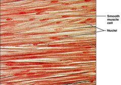 <p>What type of muscle tissue is this?</p>