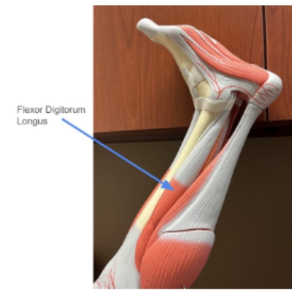 <p><span style="background-color: transparent; font-family: "Times New Roman", serif;">Flexor Digitorum Longus</span></p>