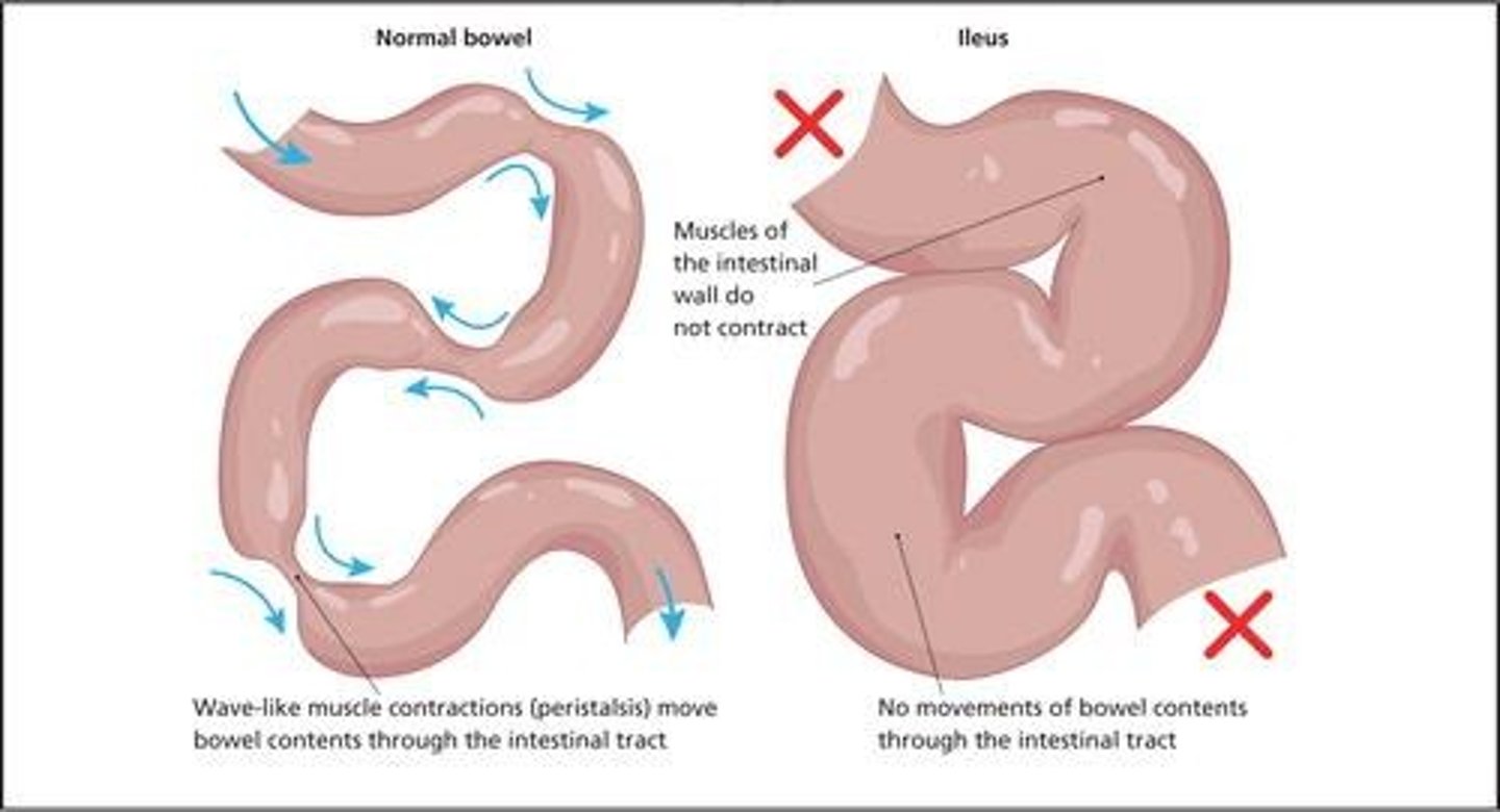 <p>Inflammation of the small intestine; may be viral or bacterial</p>
