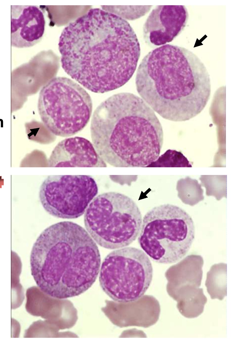 <p>Name this cell and the main points for identification</p>