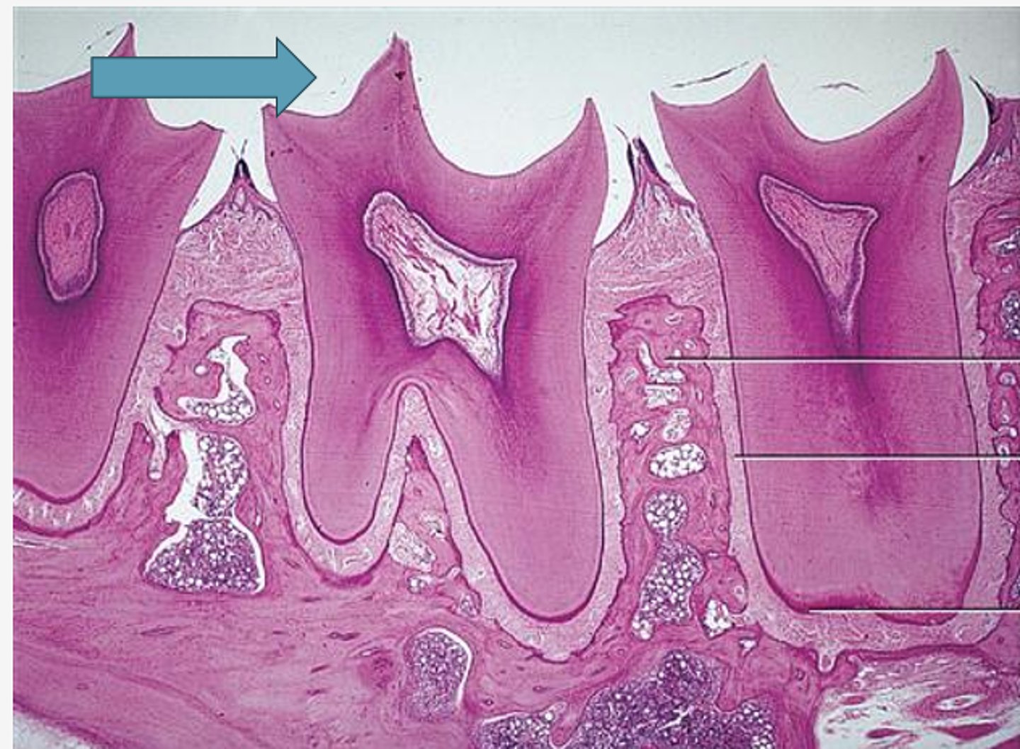 <p>Identify the region of the tooth</p>