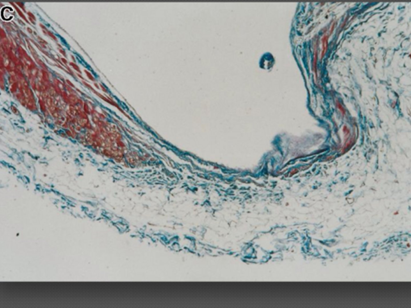 <p>Identify the condition?</p>