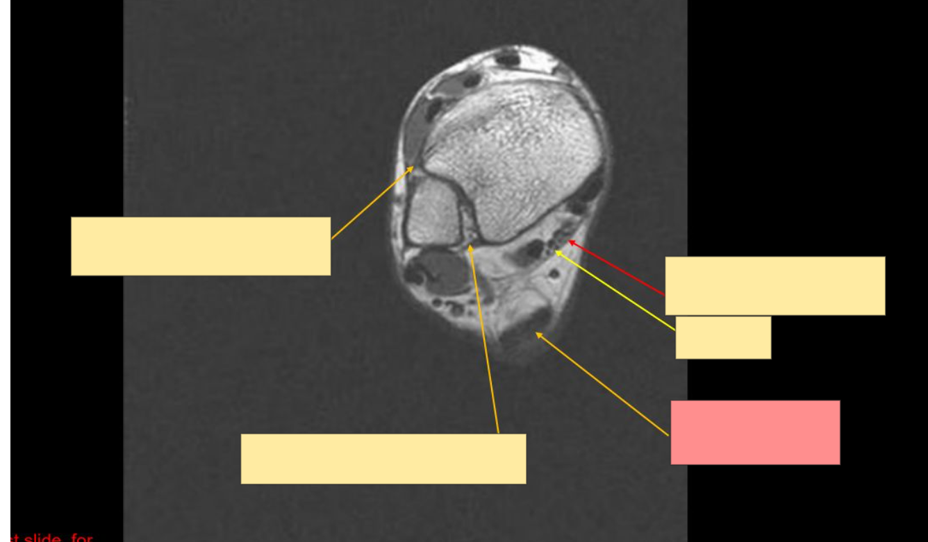 <p>Identify this structure</p>