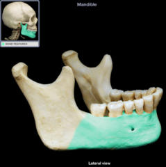 <p>Horizontal portion of the mandible</p>