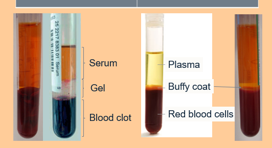 <p>Plasma will have a buffy coat⦠The blood has NOT clotted and therefore will have a buffy coat between RBC and plasma⦠</p>