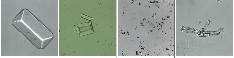 <p>Triple Phosphate Crystal</p>