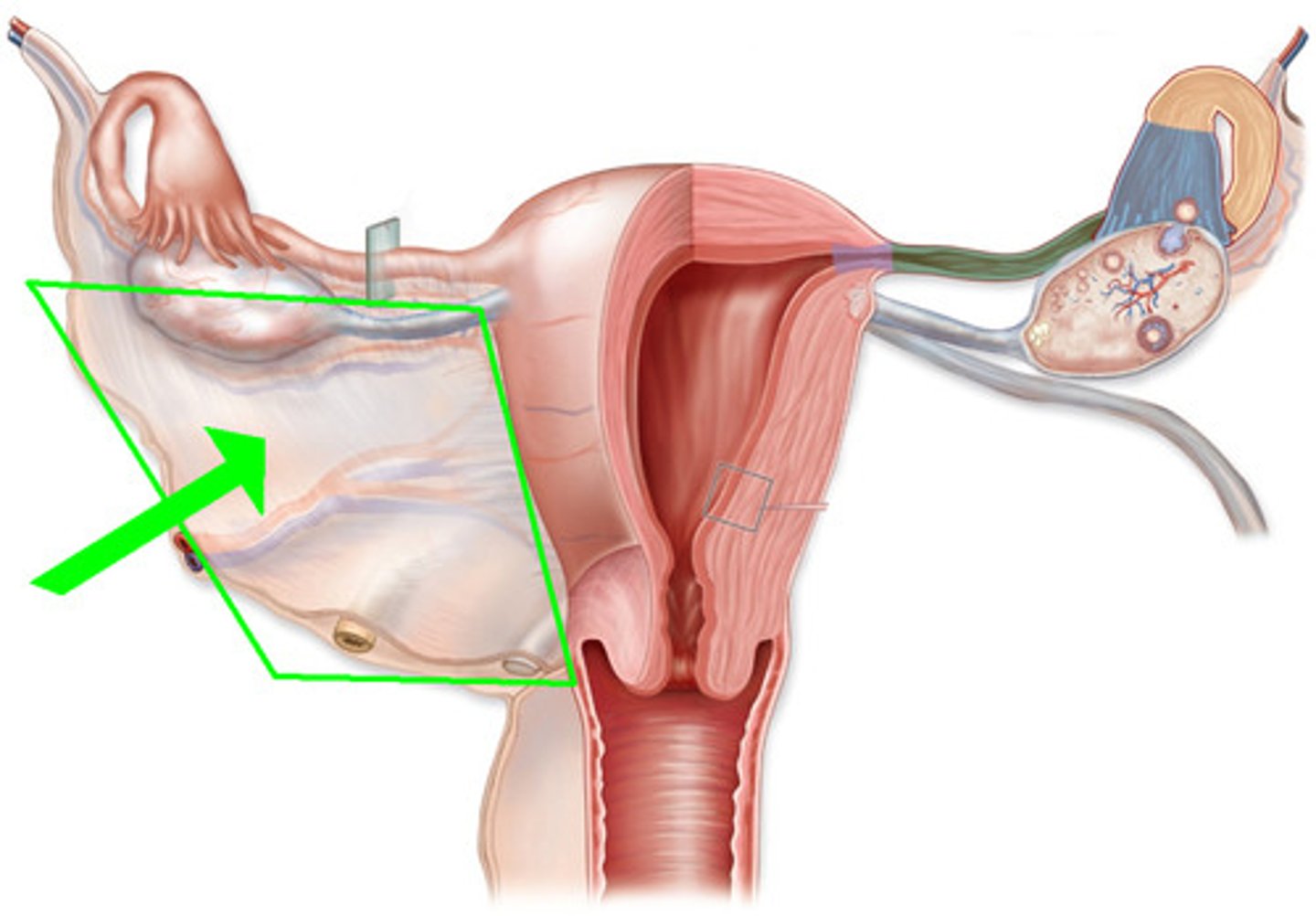 <p>peritoneal fold; supports the uterine (fallopian) tubes, uterus and vagina and encloses the ovarian ligament</p>