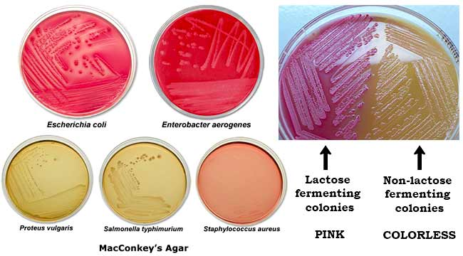 <ul><li><p>Select for GNR (bile silts and crystal violet inhibit GP) </p></li><li><p>Differentiates lactose fermenters/non-fermenters </p></li></ul><p></p>