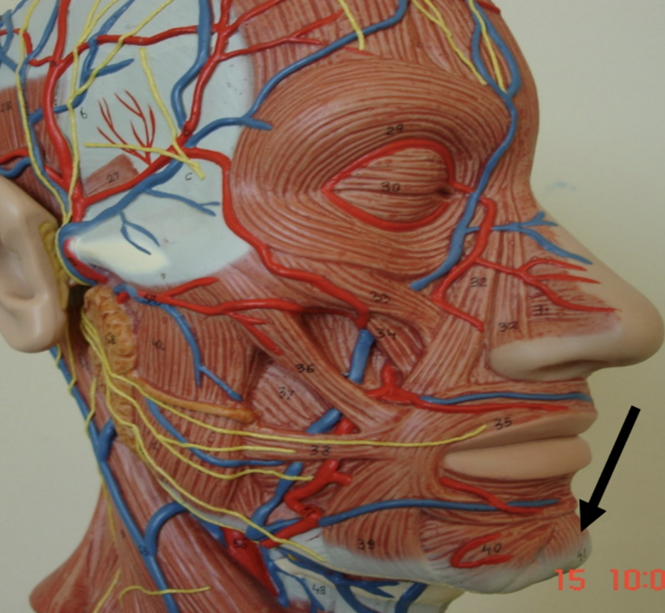 <p>Identify the muscle indicated by the pointer.</p>
