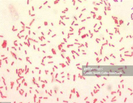 <p><u>Kleine</u> gramnegatieve staven tot coccobacillaire vormen! </p>