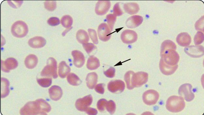 <p>What abnormal RBC shape is shown?</p>