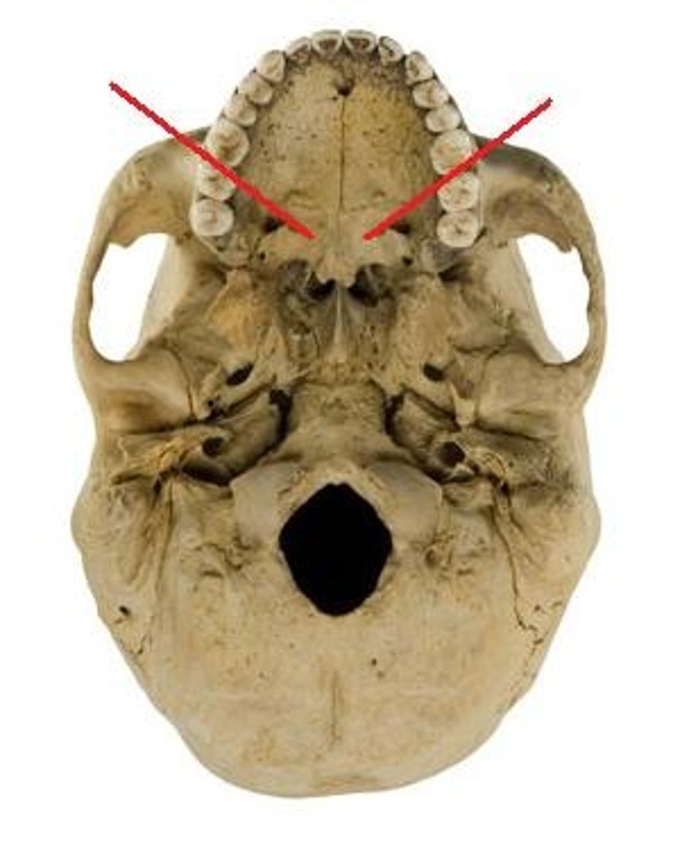 <p>ID bone at arrow</p>