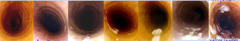 <p>You can score mucous in the trachea. What is the scale?</p>