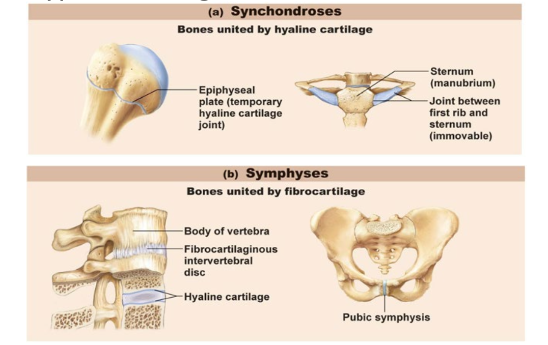 <p>Synchondroses</p><ul><li><p>United by hyaline cartilage</p></li></ul><p>Symphyses</p><ul><li><p>United by fibrocartilage</p></li></ul><p></p>