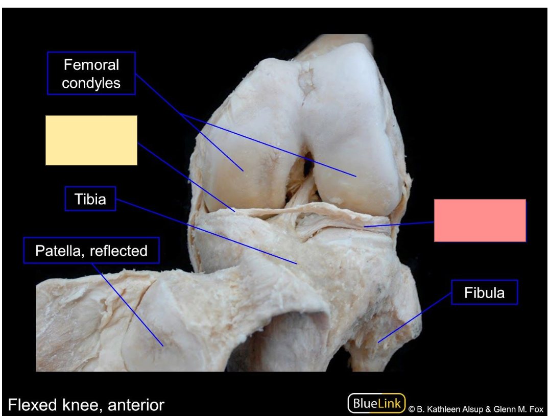 <p>Identify the structure</p>