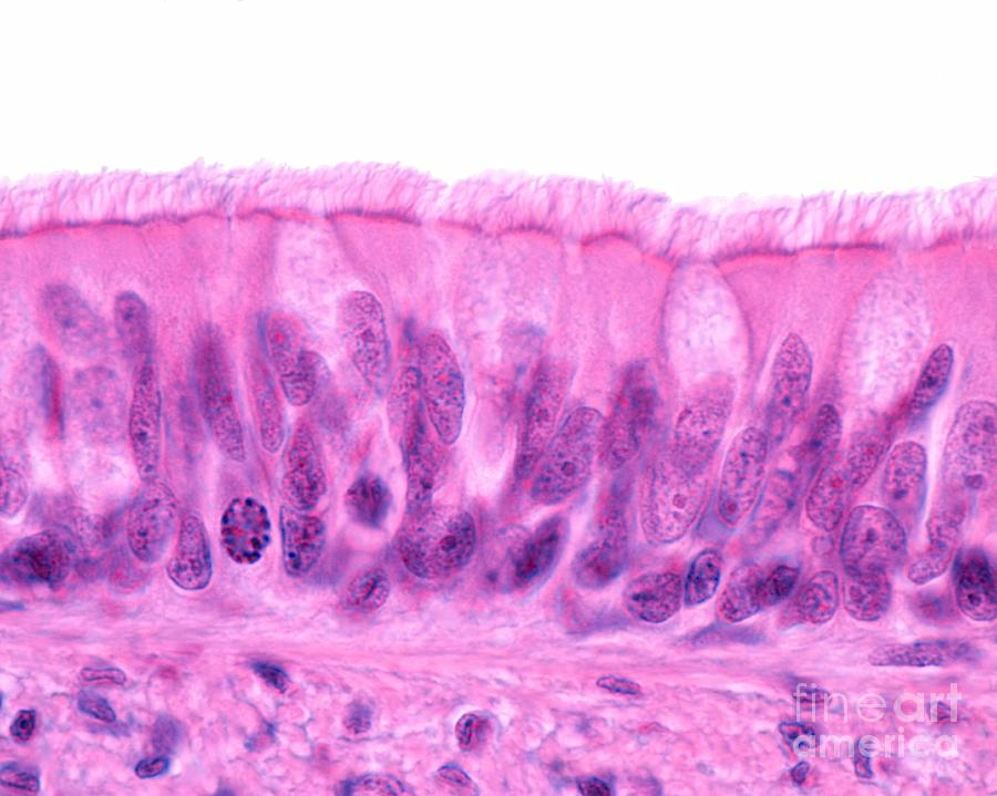 <p>Picture from trachea</p>