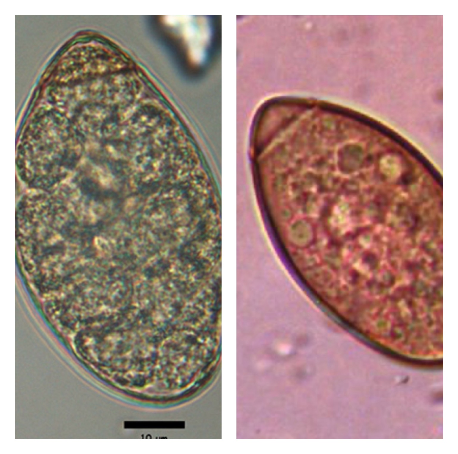 <p><span><strong><span>First Intermediate Host:</span></strong><span> Tiny freshwater crustaceans ingest the hatched parasite embryos in the water, which then develop into procercoids.</span></span></p><p><span><strong><span>Second Intermediate Host:</span></strong><span> Vertebrates such as frogs, snakes, birds, or mammals. When the copepod is eaten, the larvae migrate to the muscles and tissues, developing into a stage called a plerocercoid (sparganum).</span></span></p><p></p><p><span><span>Definitive host of this pseudotapeworms is cats, raccoons, dogs and other carnivores.</span></span></p>