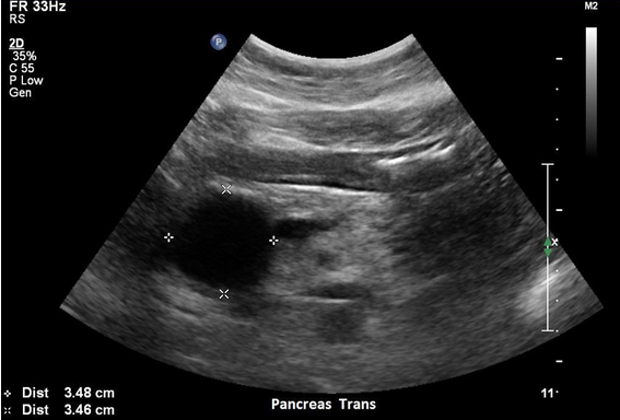 <p>What pathology is this</p>