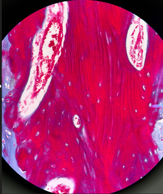 <p>ID tissue</p>