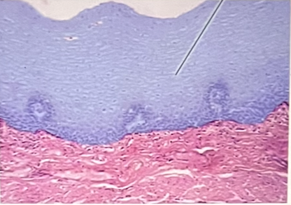 <p>identify the highlighted epithelium at the pointer</p>