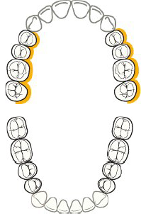 <p><strong>Upcoming flashcards practice for finger rest (</strong><span style="color: rgb(255, 0, 0);"><strong>Maxillary posterior, toward</strong></span><strong>)</strong></p>
