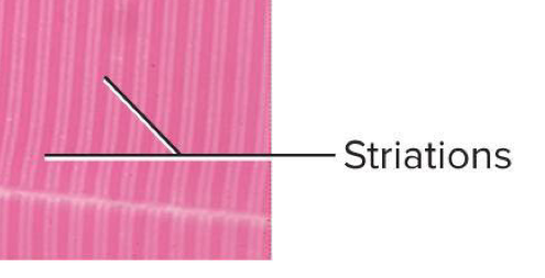 <p>Alternating light and dark transverse bands in skeletal muscle → result from the arrangement of internal contractile proteins (actin and myosin filaments) </p>