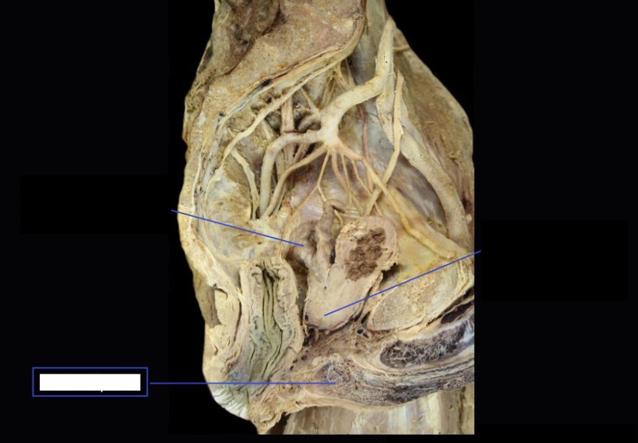 <p>Identify</p><p>Side Question:</p><p>This is the proximal (expanded) part of?</p><p>Lies in the midline of?</p><p>At the root of penis anterior to which structure?</p><p>Continues as the?</p><p>Surrounded by what muscle?</p><p>NVS?</p>