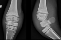 <p>What tells us this image is of septic physitis?</p>