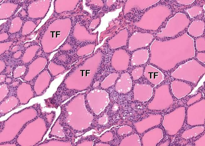 <p>thyroid gland</p>