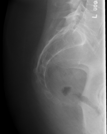 <p>critique this sacrum lateral</p>