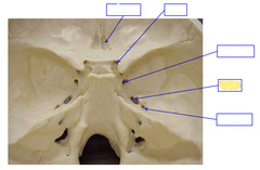 <p>Cranial Foramina</p>