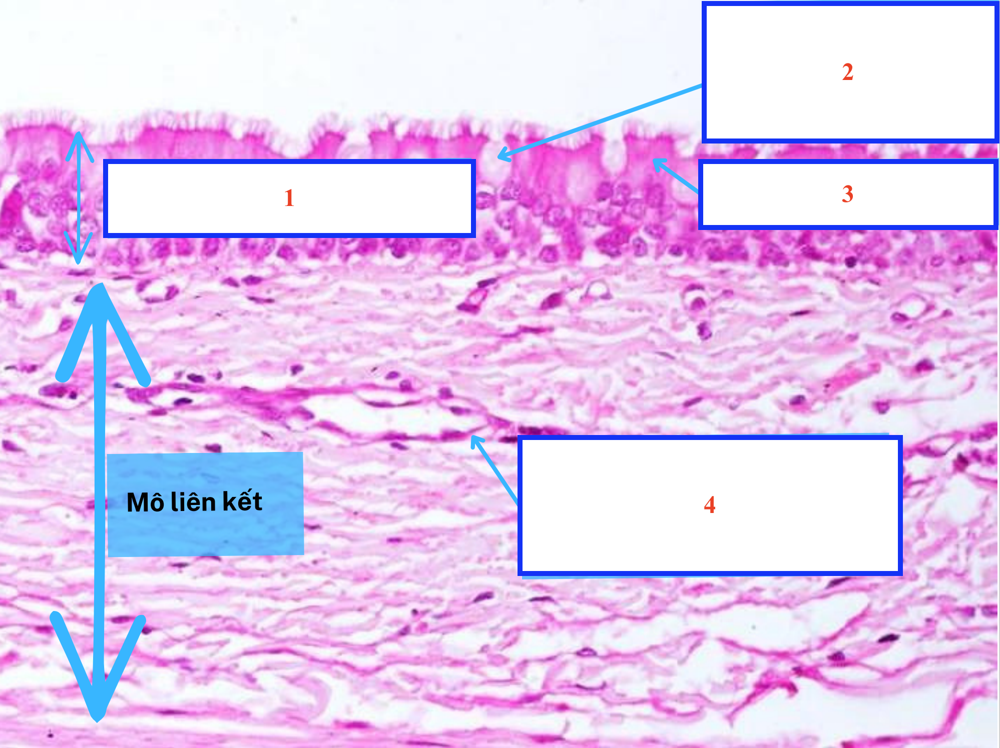 <ol><li><p>Biểu mô gì ?</p></li><li><p>Tế bào gì ?</p></li><li><p>Tế bào gì ?</p></li><li><p>Cấu trúc gì ?</p></li></ol><p></p>