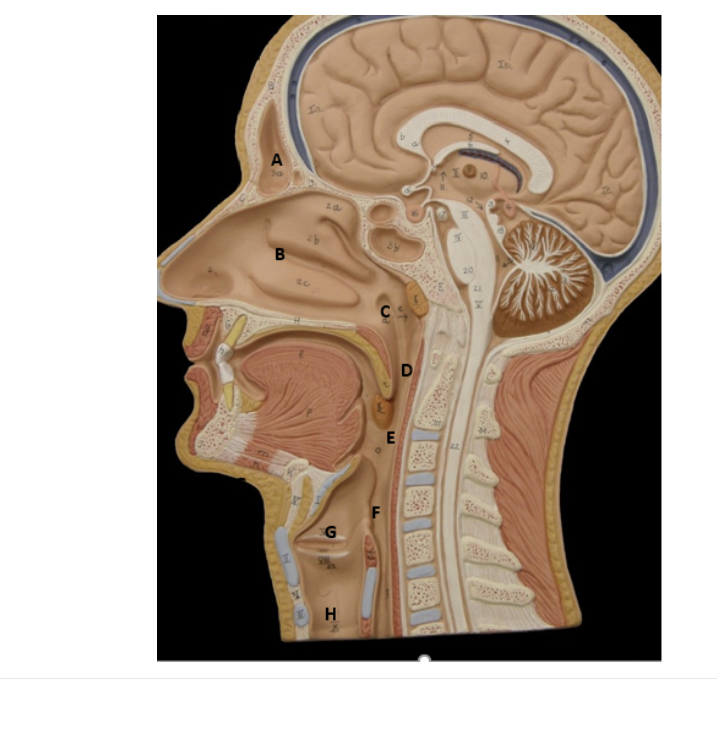 <p>fill in the blanks:</p>