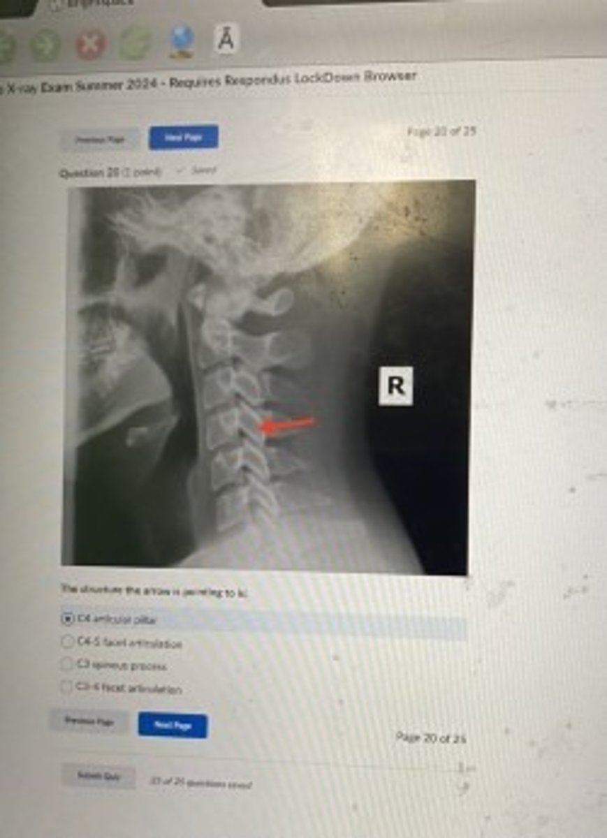 <p>C4 articular pillar</p>