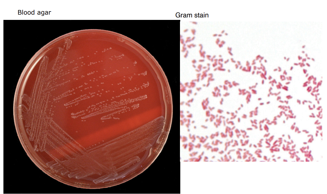 <p>Bacteroides fragilis</p>