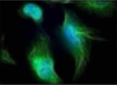 <p>Chez ce protiste les filaments d’actine suivent sa morphologie </p>