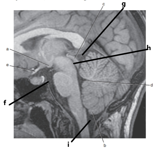 <p>What is letter h ?</p>