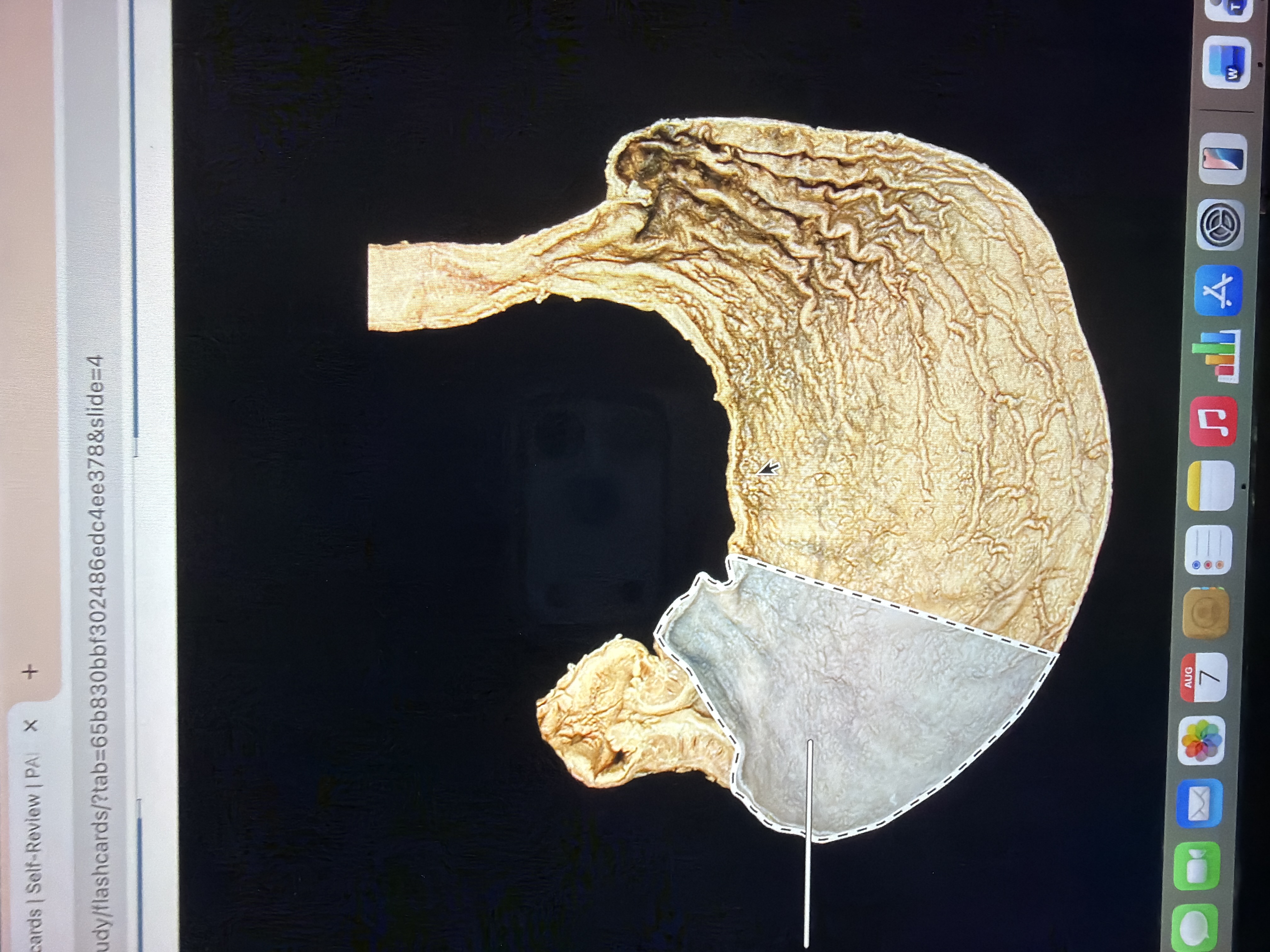 term image