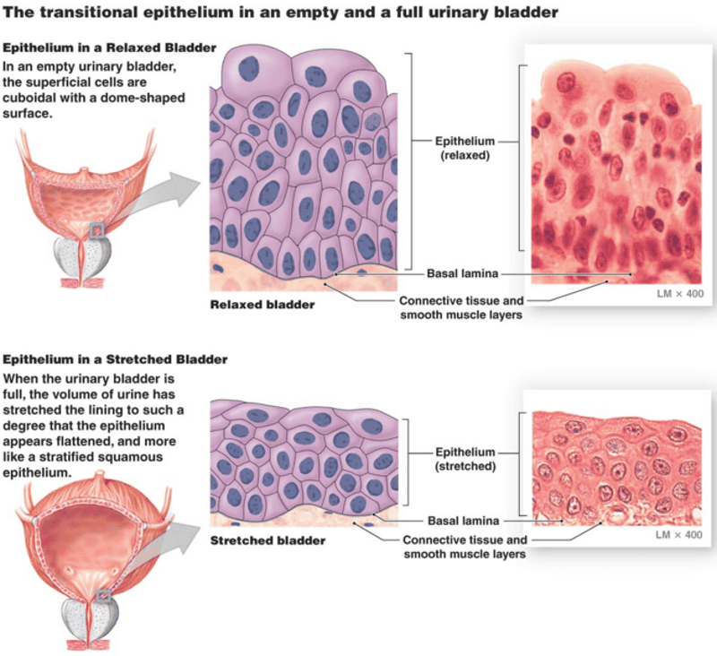 <p>Transitional epithelium</p>
