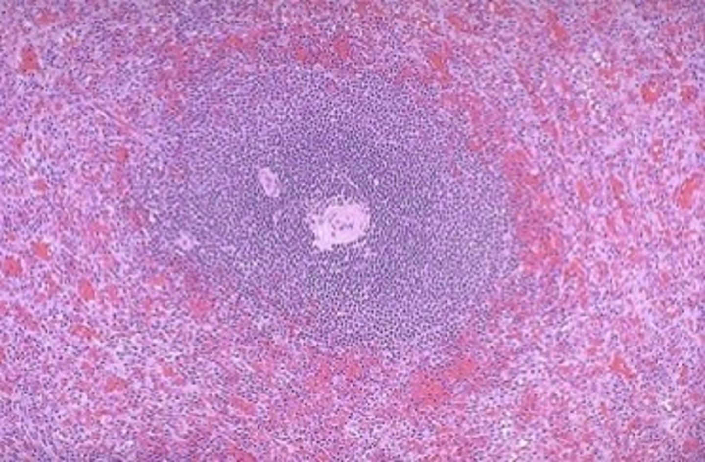 <p>What is this histology slide showing?</p>