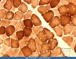 <p>cytochrome c oxidase (COX) results</p><p>brown:</p>