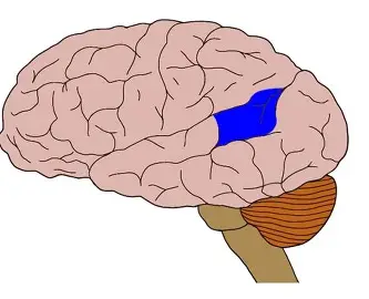 term image