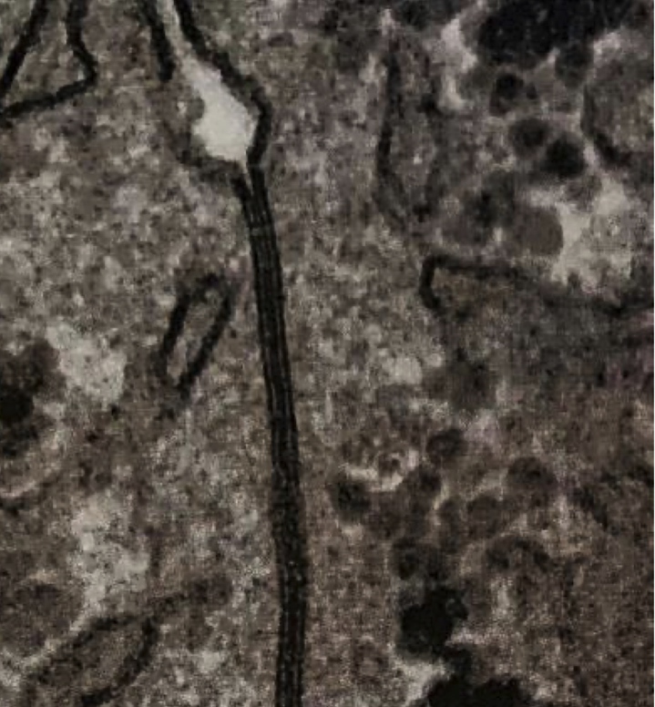<p>lines across very hard to see</p>