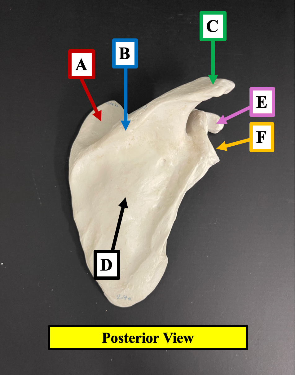 <p>Identify the name of the depression of the scapula that label <strong>A </strong>is pointing to.</p>